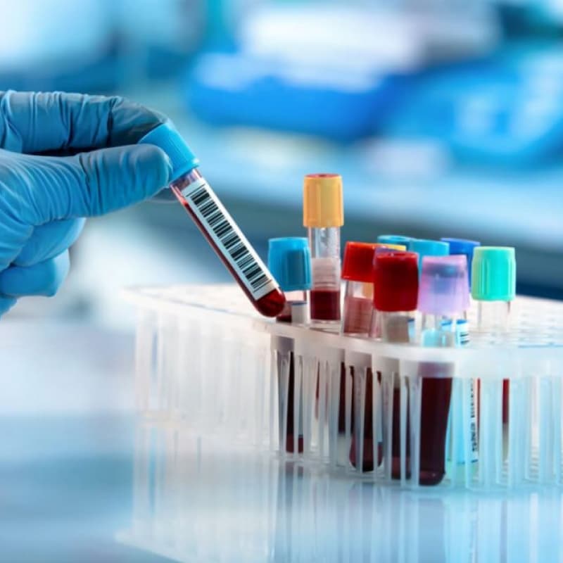 TACROLIMUS ASSAY