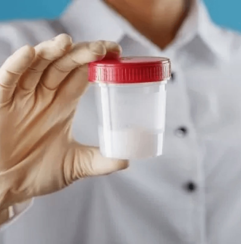 Semen fluid analysis