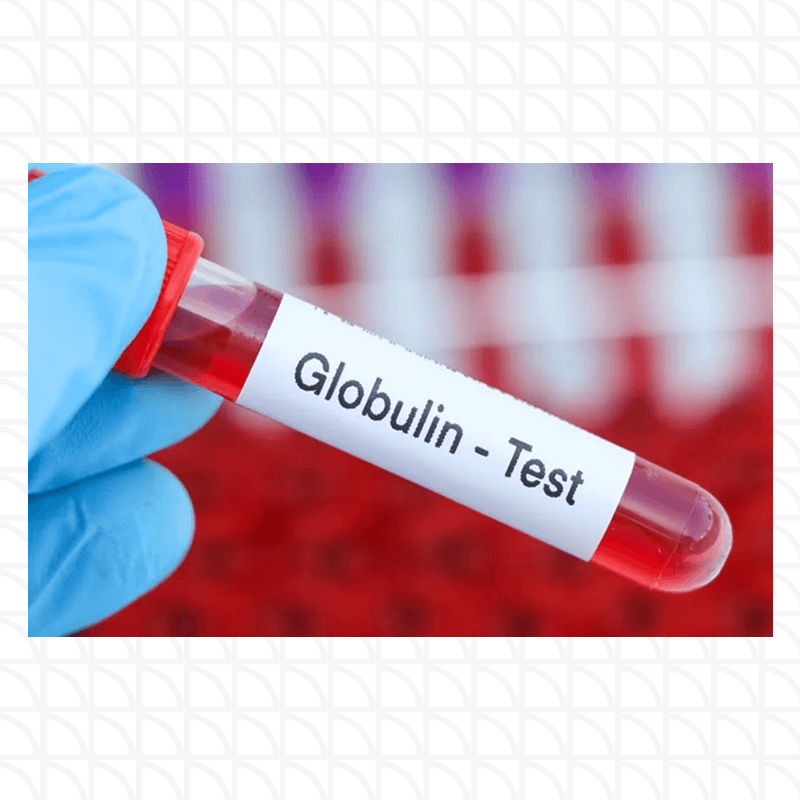 Globulin test